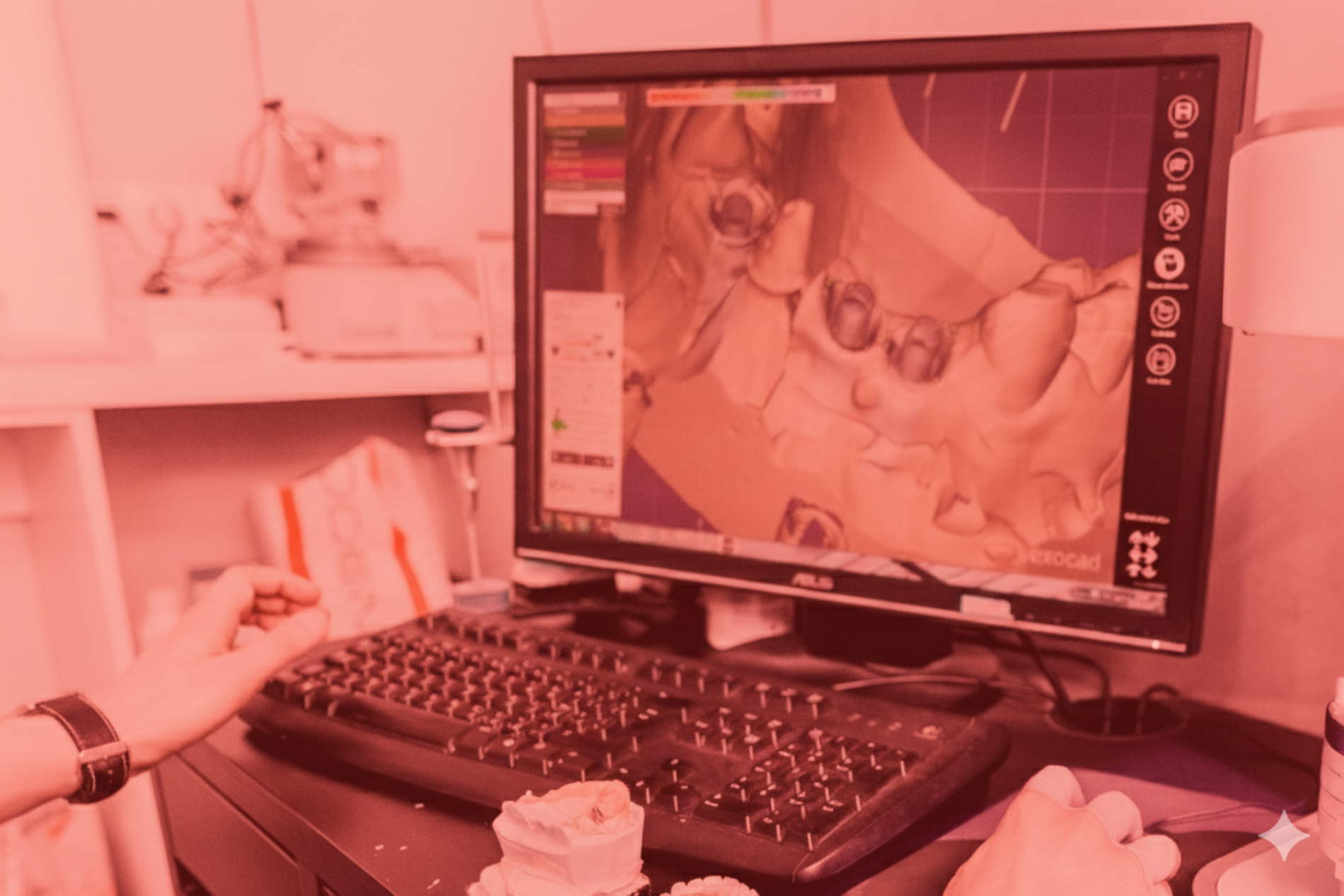 Modelli dentali e librerie CAD/CAM